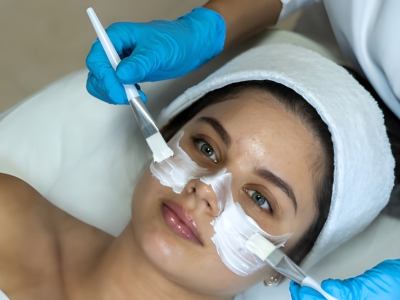 Chemical Peel Treatment