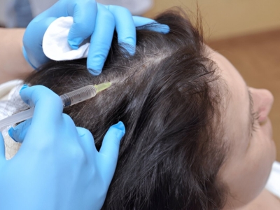 Hair Loss Treatment Gurgaon